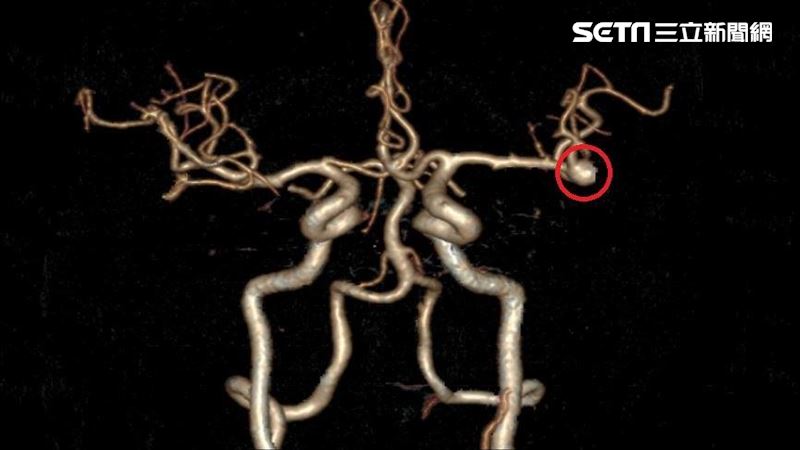 男頭內藏不定時炸彈　頭被打開變這樣
