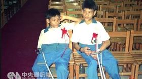 ▲亞洲第一對連體嬰分割成功的忠仁、忠義兄弟。（資料照／中央社）