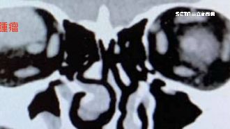 科學家研究出來了！「它」能精準殺癌細胞