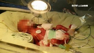 辛苦拉拔巴掌仙子　母控子遭師捏傷