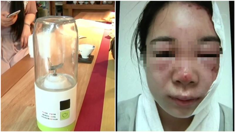 果汁機爆炸害毀容…她哭：我靠臉吃飯