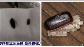 癢炸！驚見耳內「咖啡色彈匣」全孵化（圖／翻攝自央視頻道）