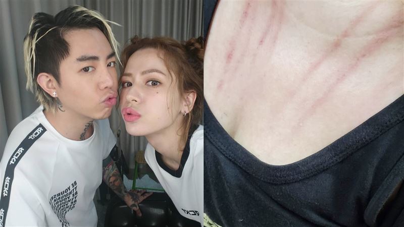 謝和弦前妻和小三庭外拉扯　滿身血痕