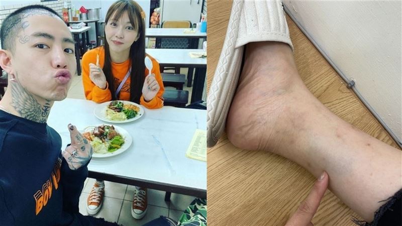 遭控抓出血痕　莉婭曬指甲照自清反擊