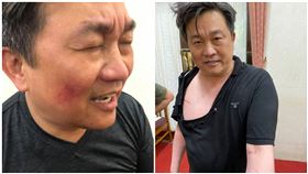 王定宇自己也在臉書貼出三張照片表示，不敢說這樣是「皮開肉綻」，議事激烈衝突難免（圖／合成圖翻攝自羅美玲、王定宇臉書）