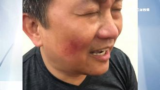 王定宇滿身血痕　綠委控：有人偷打！