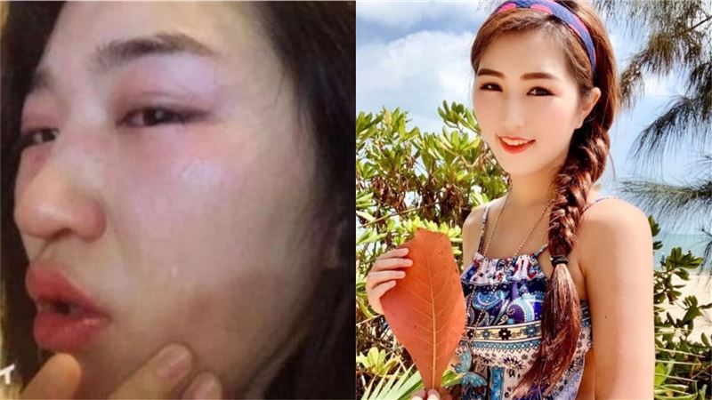在飯店穿著曝露　女星自爆遭人硬上