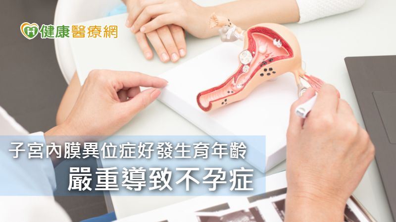 嚴重子宮內膜異位症想懷孕？