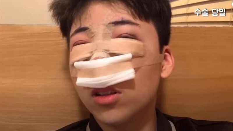 高中生被罵不像朴寶劍　去整型又挨酸