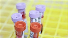 最新研究發現，由一間新創公司所研發的血液檢驗方法，能比傳統診斷方式早好幾年偵測出5種癌症。（示意圖／圖取自Unsplash圖庫）