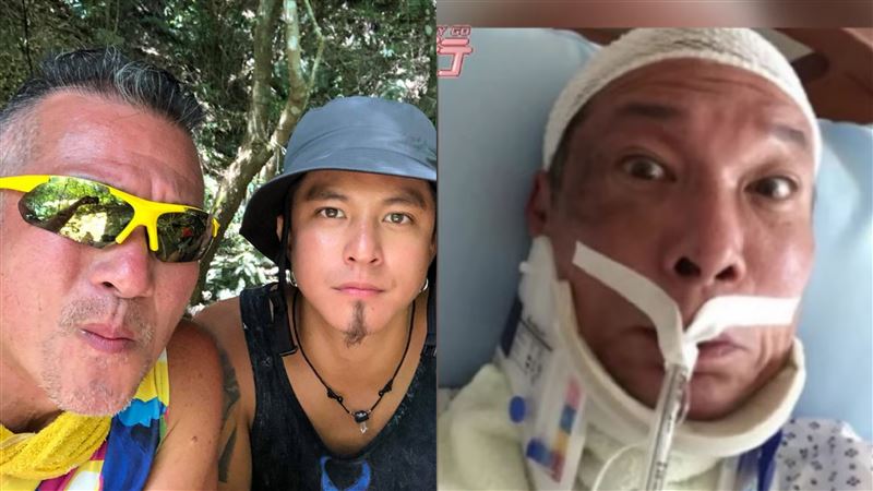 黃仲崑多年隱疾纏身　曝腦部開刀過程