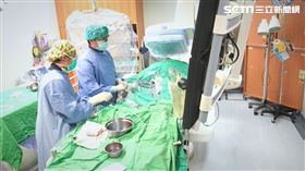 心導管手術,醫師,手術,治療,開刀,看診,醫院（圖／記者羅正輝攝影）