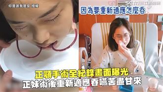 正顎手術畫面曝　她術後重新適應吞嚥