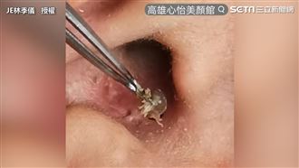 2洞相連超頑固　巨型黑頭拉出嚇屎人