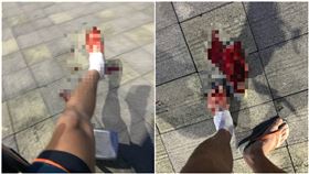  玩水注意！他沙灘「遇刺」狂噴血…網見這點嚇壞：小心截肢（圖／翻攝自DCARD）