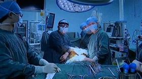 中國大陸,婦人,腫瘤,子宮,心臟,靜脈內平滑肌瘤（圖／翻攝看看新聞）