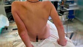  13歲少年跌倒後，遭魚竿刺穿。（圖／翻攝自manolhs推特）