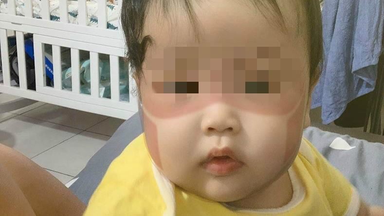 太陽太毒辣　她曬兒口罩特效照網驚呆