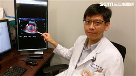 長安醫院有新的攝護腺治療方式，於是前來諮詢看診，經心臟血管科鄭詩璁醫師檢查，發現攝護腺已腫大至383克，是正常人的快20倍大，從栗子變葡萄柚。（圖／長安醫院提供）