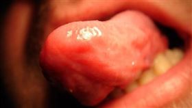 舔,舌頭／Flickr-macronix