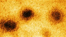 新冠病毒（長庚提供）