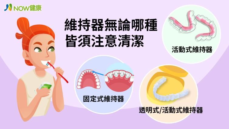 矯正牙齒須配戴維持器 清潔不可馬虎