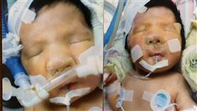 罕病男孩恩恩（記者戴華辰攝影）