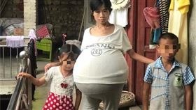 （圖／翻攝自貴陽晚報）中國,巨肚