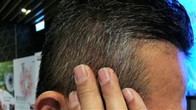 造成白頭髮的原因除了正常的年齡老化外，也會受到遺傳性少年白、代謝疾病、抽菸及紫外線等因素影響。(示意圖非新聞當事人／記者楊晴雯攝)