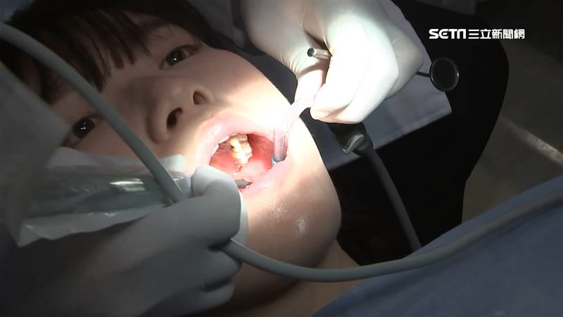 牙縫卡菜渣　錯誤清潔恐越剔越髒！