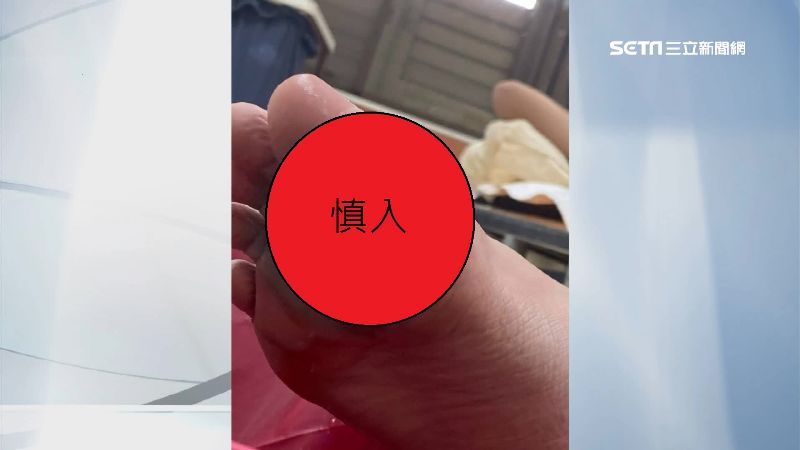 蘇澳問題泳池再出包　鋼條割傷男童