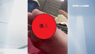 蘇澳問題泳池再出包　鋼條割傷男童