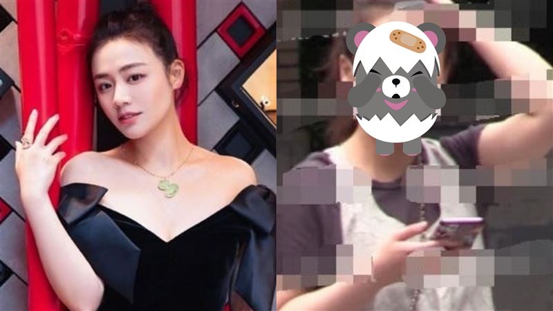 影后爆全身僵硬失明　腫一圈赴精神科