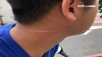 雙載突遭風箏線勒脖　男臉、頸濺血