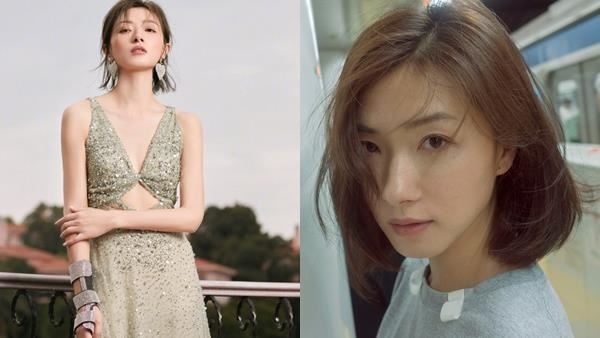 金馬女星爆車禍　骨折神經受損近況曝