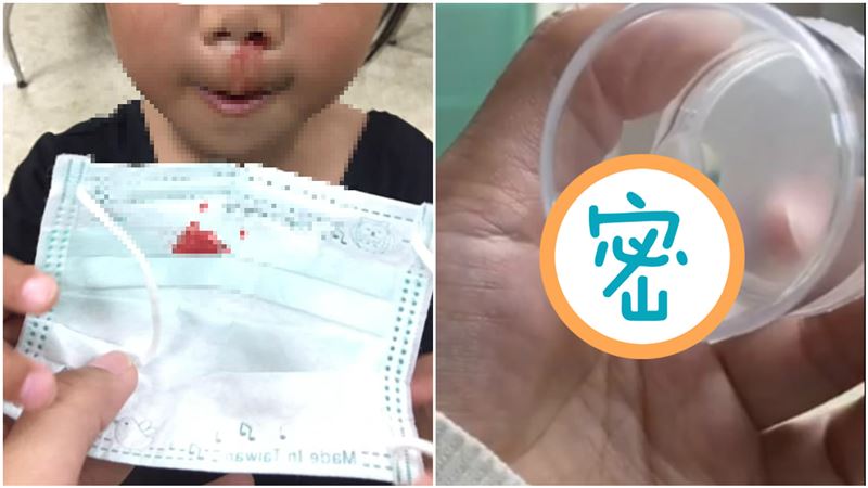 玩水注意！2歲童鼻血狂流竟是被蟲鑽
