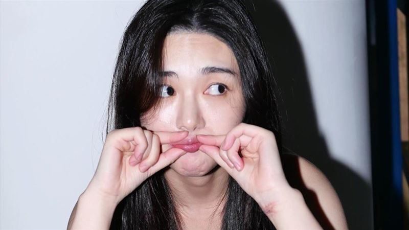女星自殘3次後神隱　公司宣布已解約