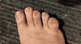 ▲小腳趾有兩瓣甲。（圖／三立新聞網）