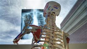 肺部Ｘ光（Pixabay）