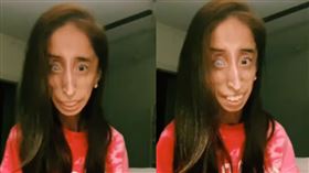 全世界最醜的女人？自拍照被家長拿來錄影「嚇」小孩，她向Tik Tok發聲抗議(圖/Lizzie Velasquez臉書授權)