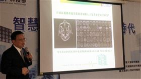 榮總解釋智慧醫療系統科技部20日舉行智慧醫療研究成果記者會，台北榮民總醫院放射線部主任郭萬祐解釋，腦轉移瘤AI輔助診斷系統是以台北榮總過去30年由專業放射科醫師所標註1000筆以上個案作初始模型訓練。中央社記者蘇思云攝  109年8月20日