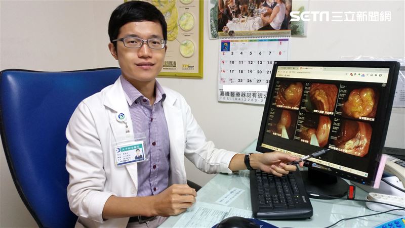 切大腸瘜肉後就抽菸　50歲男腸穿孔
