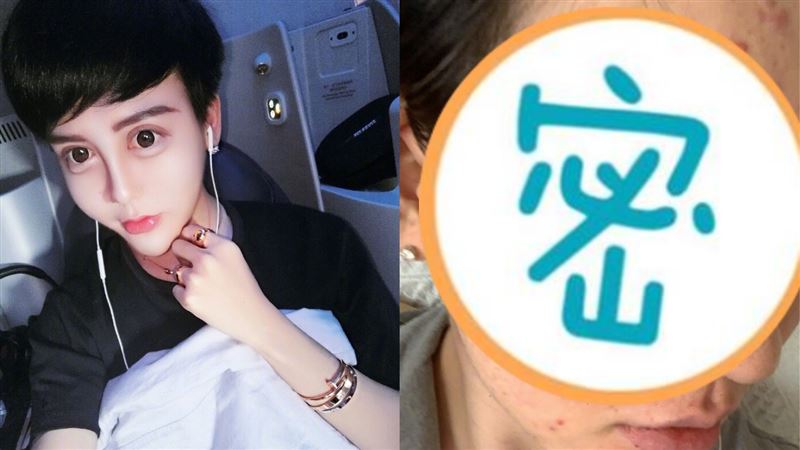 整壞了？蛇精男神隱3個月驚爆毀容