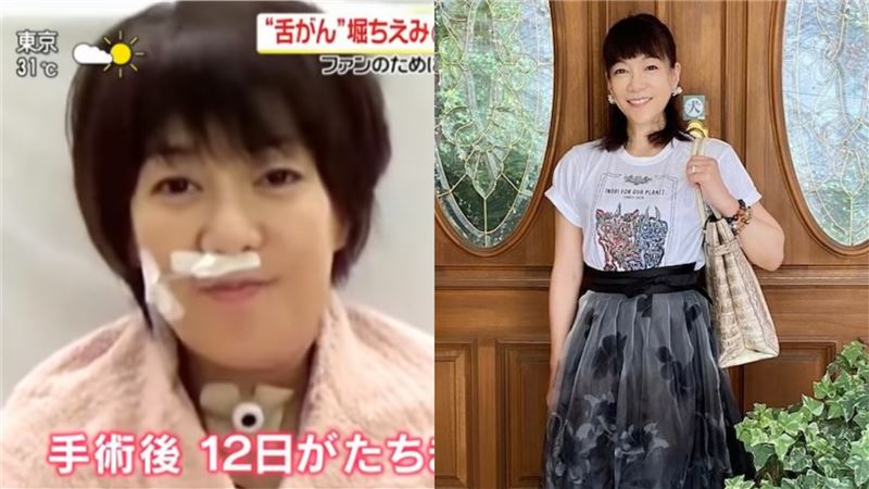 割6成舌又罹癌　女星復唱跪地痛哭