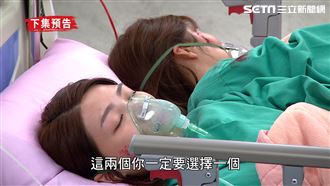 連體嬰車禍命危　爸心碎「2選1」