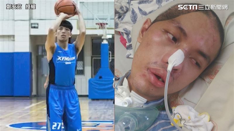 5個月後奇蹟甦醒　校隊男重拾籃球
