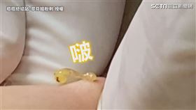 ▲擠出飽滿的粉刺油花。（圖／痘痘終結站-翠芬姐粉刺 授權）