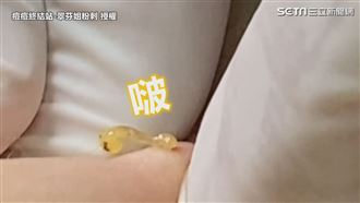 晶瑩粉瘤俐落拉出毛囊　一擠啵出油花