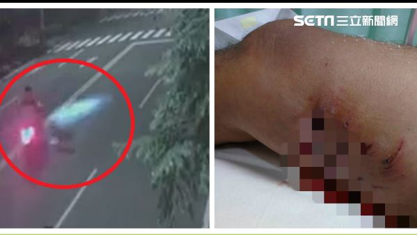 雲林比特犬發狠追車 騎士遭咬狂噴血