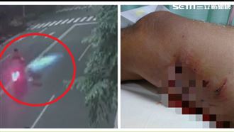 雲林比特犬發狠追車 騎士遭咬狂噴血